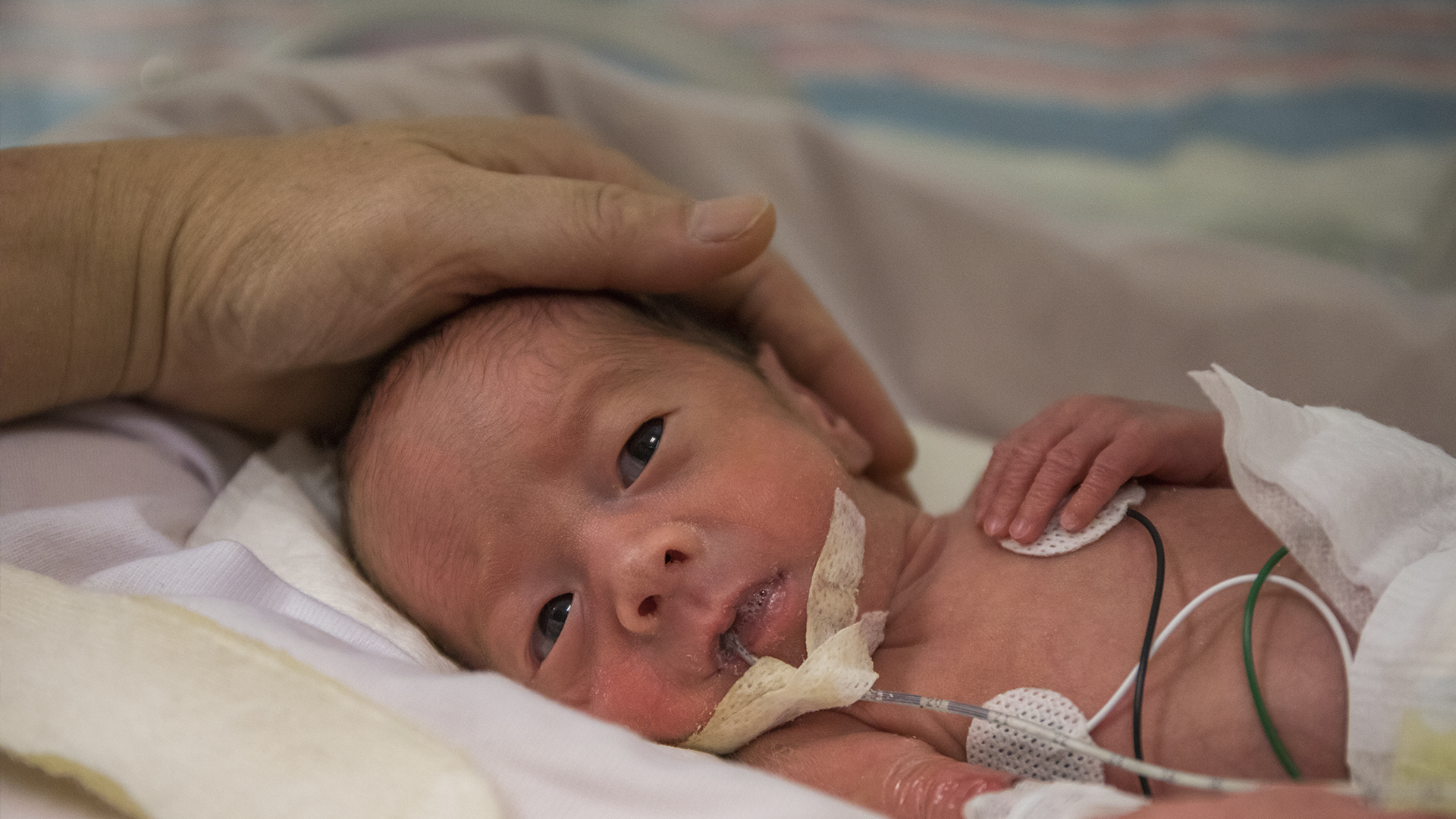 Neonato en semicríticos