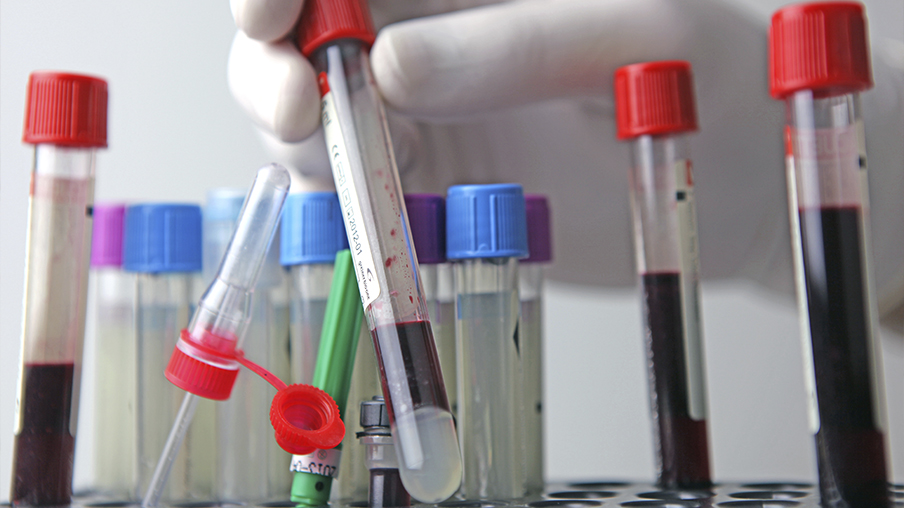 Muestras de sangre para analizar en tubos